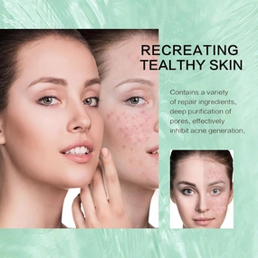 Acne Repair Mask Beauty Face Mask Skin Care Set | Natural Acne Repair Face Mask For All Skin Types (Pack of 5)